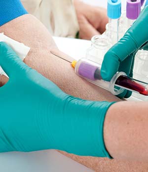 Blood Test at Your Home Service by Lab at Home in Mulund, Thane, Kalyan, Andheri, kandivali, Ghatkopar, Mumbai & Navi Mumbai.